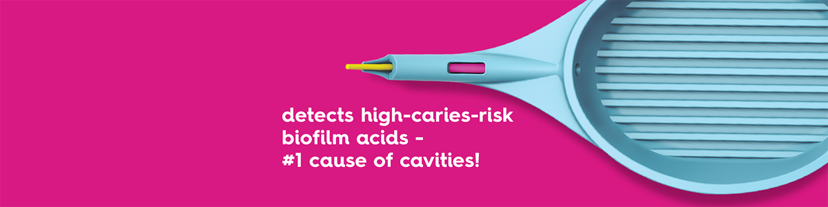 CaviSense: Catch Cavities Early