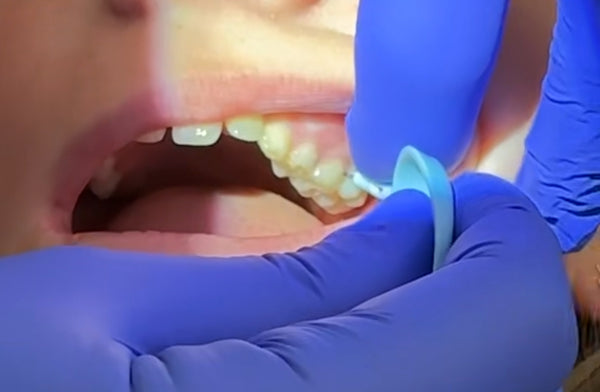 CaviSense Toothpick dispenser (contains 100 toothpicks)